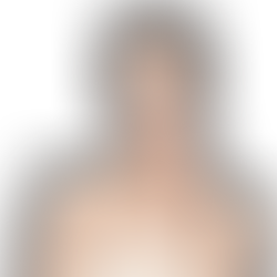 Entdecke die fünf Vorteile der revolutionären Hydrafacial-Behandlung, die deine Haut tiefenreinigt und voller Glow erstrahlen lässt.