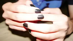 Die häufigsten Nagelprobleme und wie man sie ganz einfach behebt