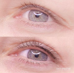 Eye enhancement