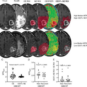 pH-Weighted amine chemical exchange saturation transfer echo planar imaging visualizes infiltrating glioblastoma cells