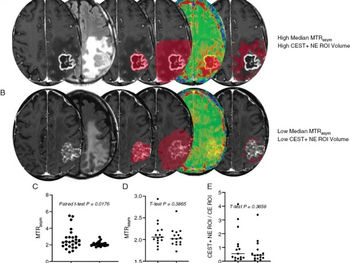 pH-Weighted amine chemical exchange saturation transfer echo planar imaging visualizes infiltrating glioblastoma cells