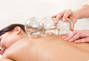 Cupping Therapy (5).jpg