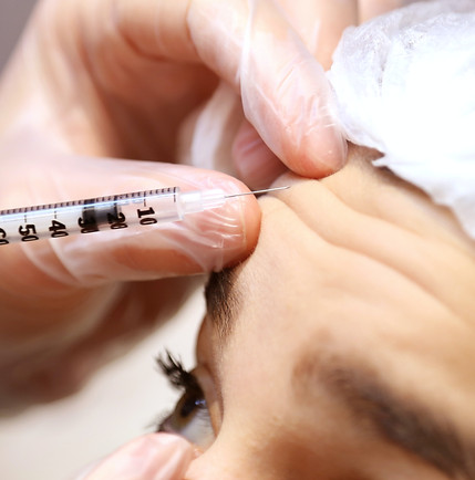 Botox Behandlung