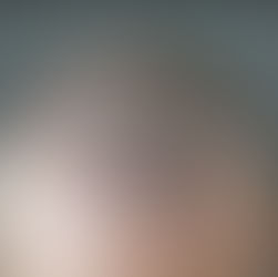 What You Need to Know About Pain and Preparation for Your First Scalp Micropigmentation Treatment