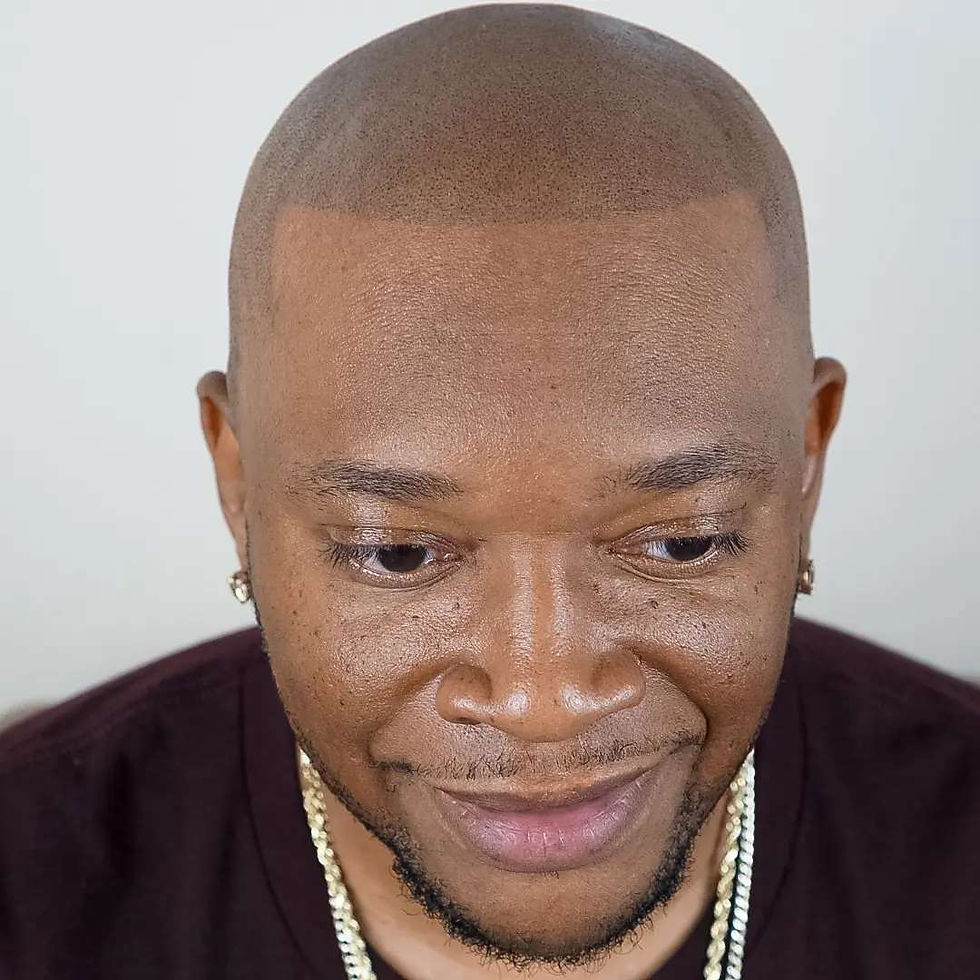 Close-up view of scalp micropigmentation procedure on a male client