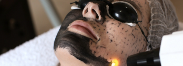 close up of carbon laser facial