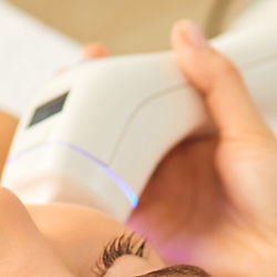 Client receiving a HIFU facial for skin tightening