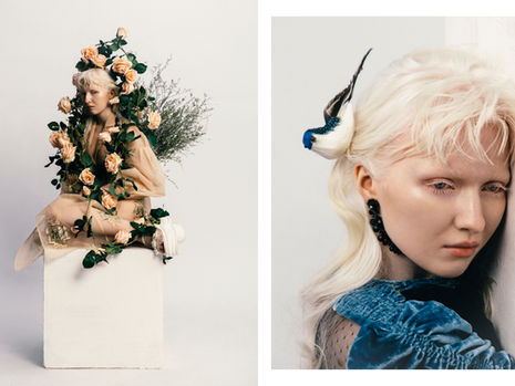 ALBINISM/S AESTHETICS
