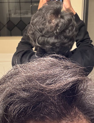 First Lady's Hair Growth