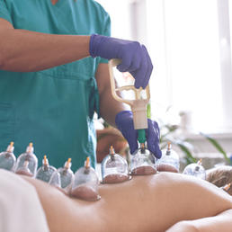 healing-bloodletting-hijama-phlebotomy-hajam-master-conducts-cupping-therapy-young-woman-i