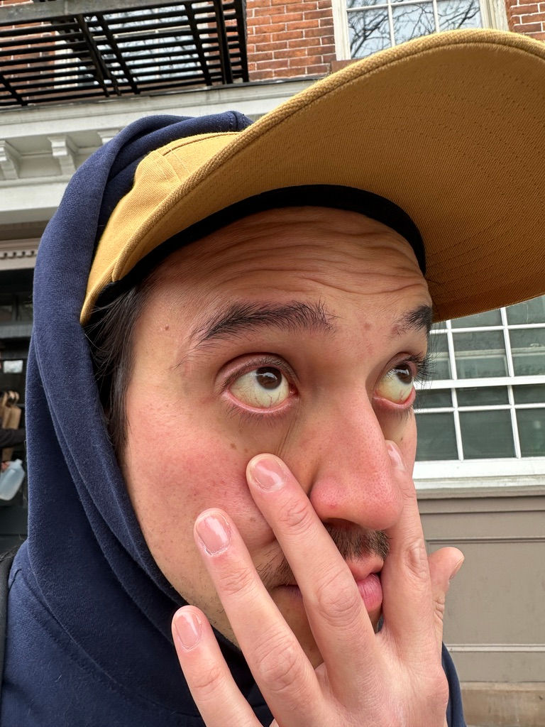 man showing eyes