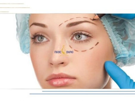 Báo giá treo chân mày mới nhất 2023