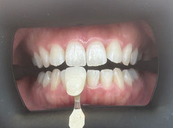 シェードチェック