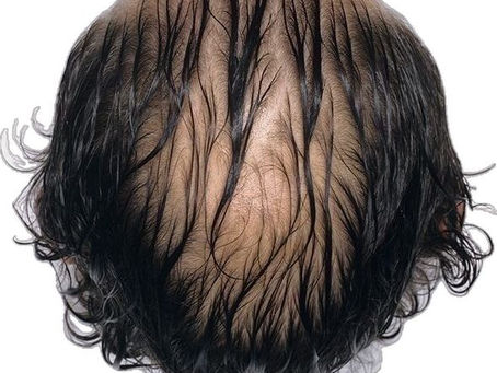 Miniaturização dos Fios: o que é e como reverter o processo antes que seja tarde demais