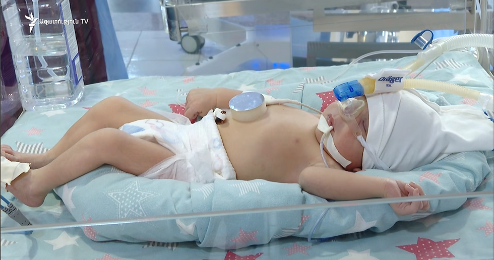 Hours-Old Baby Girl Found Abandoned in Yerevan With Umbilical Cord Still Attached