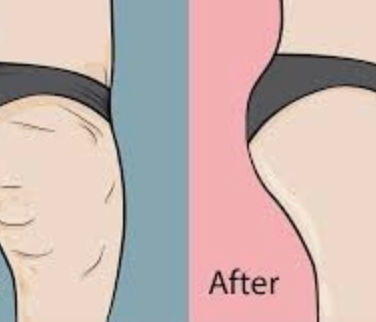 THIS 2 CRYSTALS COULD HELP YOU REDUSE CELLULITE. 