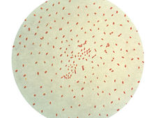 Keuchhusten - Pertussis