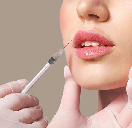 Close up of a woman's lips who is about to receive Dermal Fillers.