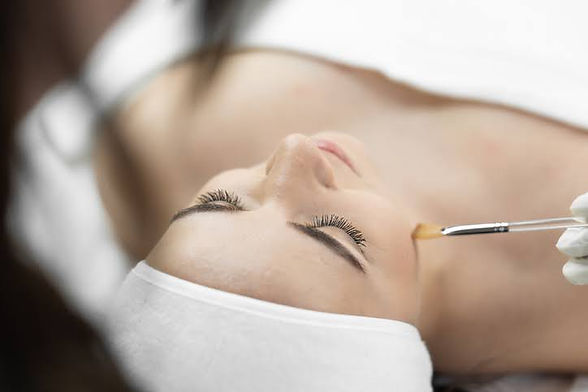 Woman lying down with her eyes closed as she recieves a Chemical Peel treatment.