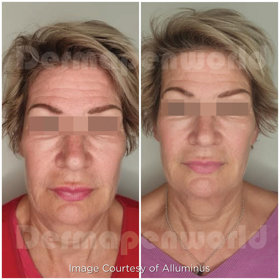 Full face aging