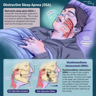2D Surgical/Anatomical Illustrations