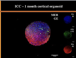 Organoids crop.jpeg