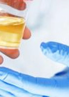 urine-drug-testing.jpg