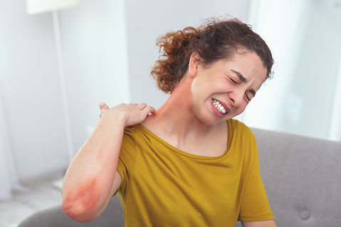 Spreading rash. Young lady in pain looki