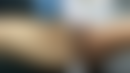 Adolescent Broken forearm!