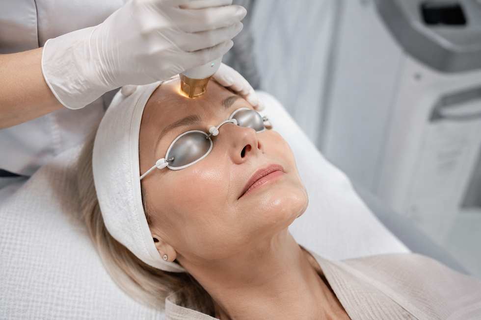 Laser Treatments for Mature Skin