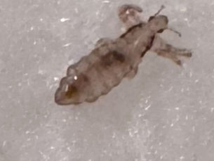 Understanding Lice: Myths and Facts Every Parent Should Know