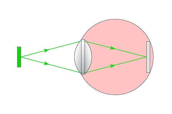 The-Human-Eye,-Close-Object-Rays.png