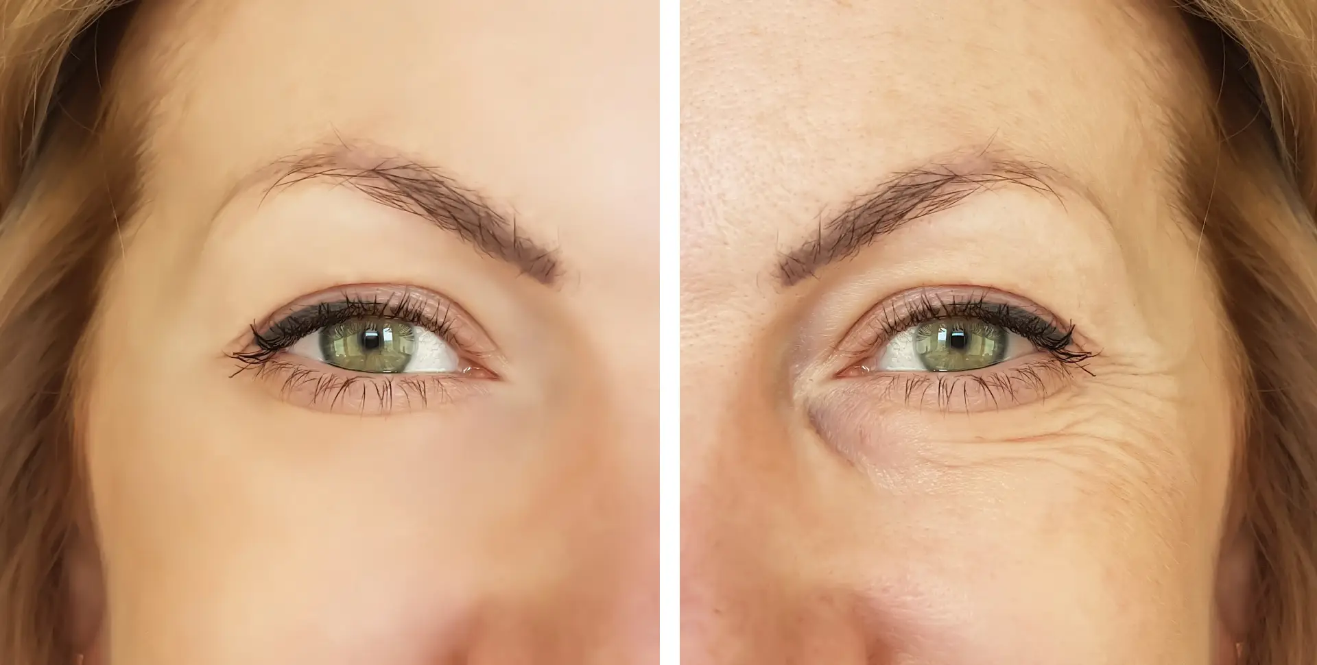 skin tightening