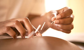 Acupuncture Therapy Session_edited.jpg