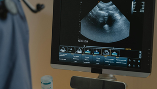 A Chinese Research Team Just Open-Sourced the Largest Ultrasound AI Dataset Ever — and Medical Imaging AI May Never Be the Same