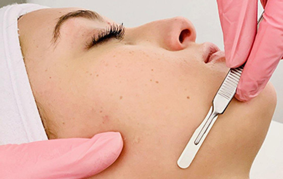 Dermaplaning-web-2.jpeg