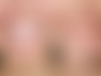 Why Do Your Teeth Remain Yellow Even After Frequently Brushing Them?