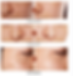 Miniatura: Herbal Astragalus Cream for Dark Spot Removal