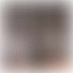 Hair Loss in Women: The Most Common Drivers