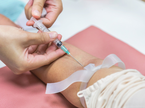 What to Do Before Lab Work (So Your Results Are Actually Accurate)