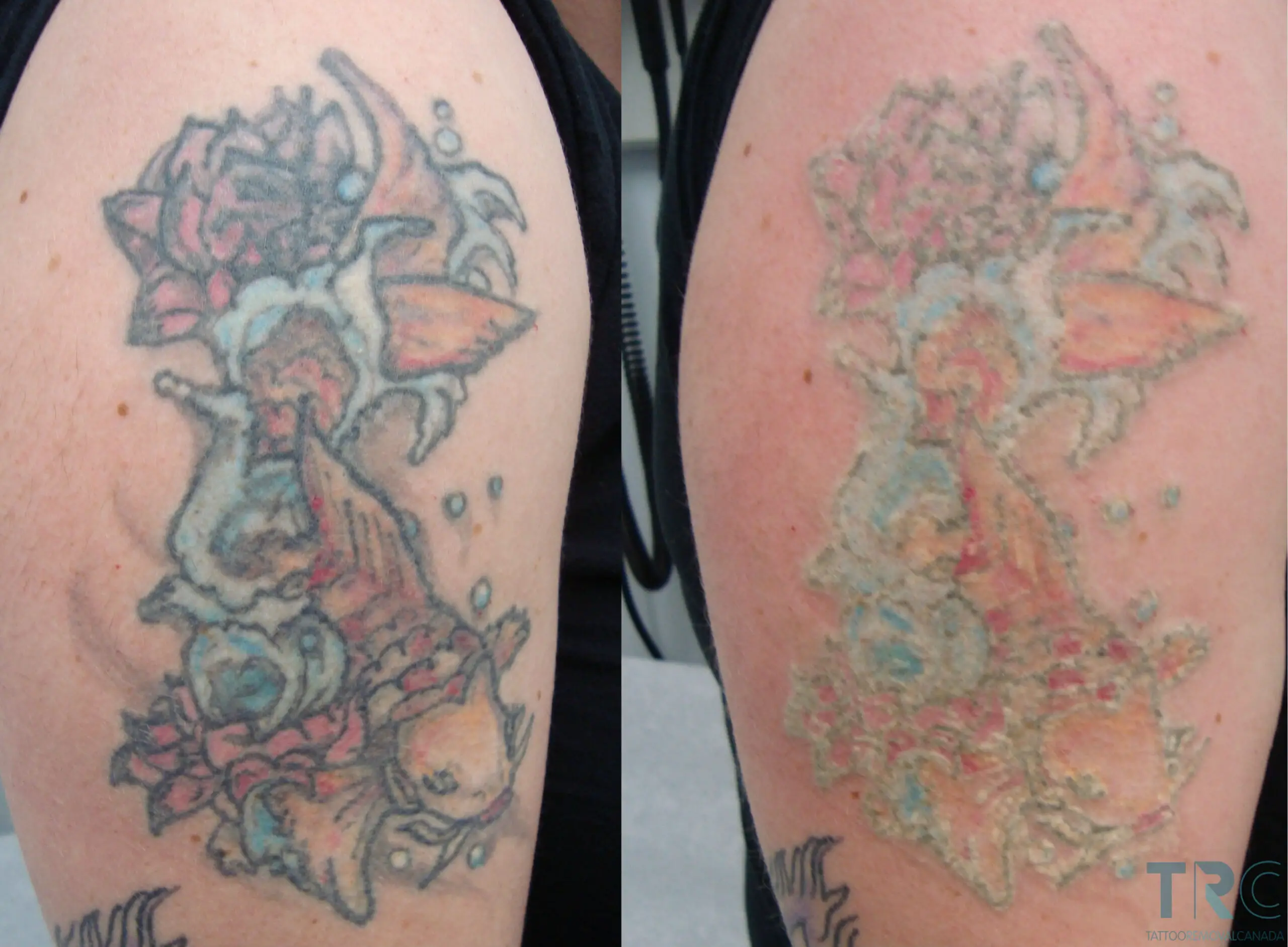 Tatuagem Desbotada Causas Preven o E Recupera o tatuagem-desbotada-causas-preven-o-e-recupera-o