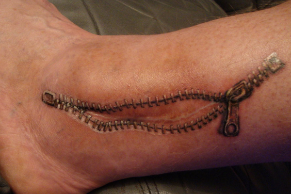 Imagem que mostra Tatuagem para Cobrir Cicatriz