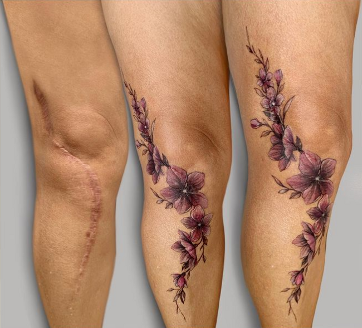 Imagem que mostra Tatuagem para Cobrir Cicatriz