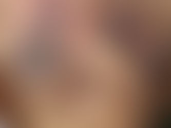 Scar Tattoos: Transforming Scars into Beautiful Body Art