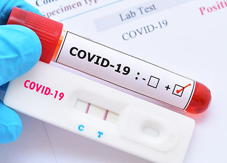 Free Coronavirus (COVID-19) Testing / Pruebas de Coronavirus Gratis (COVID-19)