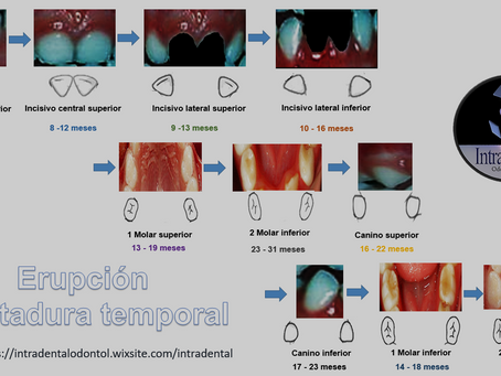 Cronología de erupción de dientes temporales