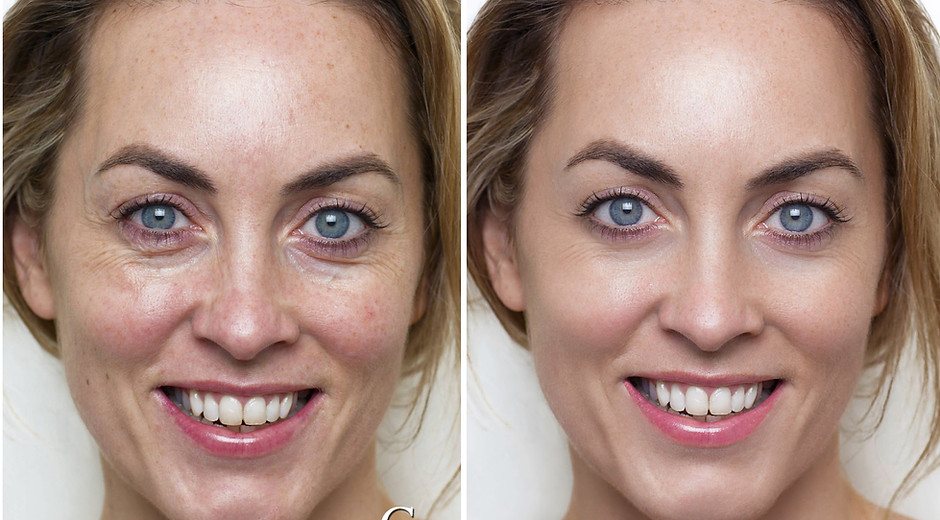 image retouching