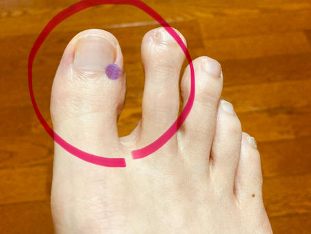 自律神経を調整し、ストレス緩和に効果的な【大敦】穴