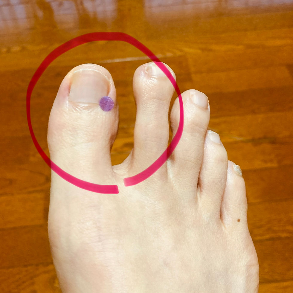 自律神経を調整し、ストレス緩和に効果的な【大敦】穴