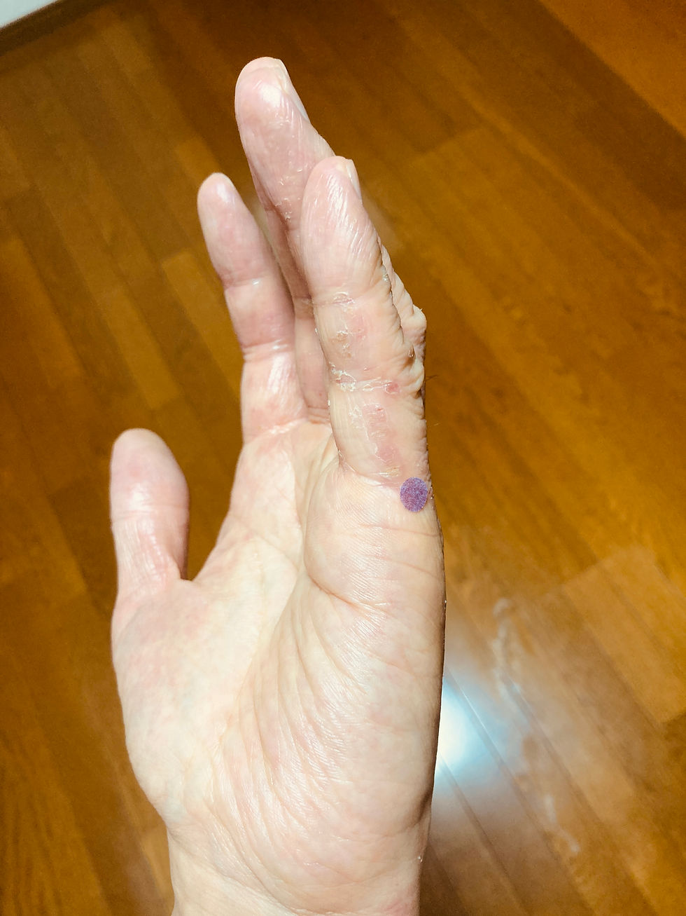 身体に籠った熱を放出する【前谷】穴 の場所を示している。